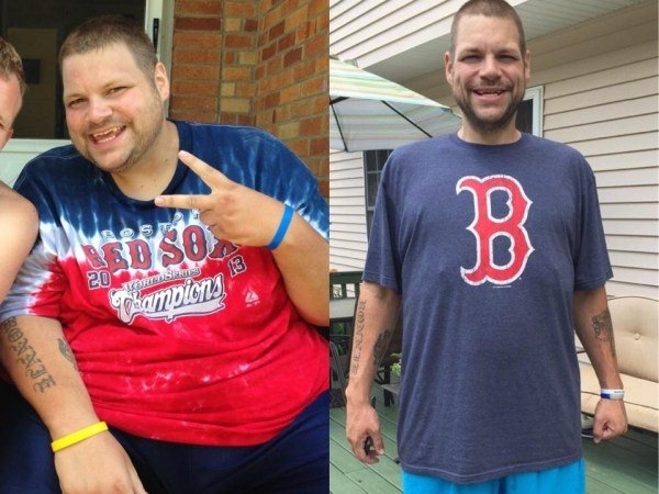 Foto - 300 kiloydu ve evden çıkamıyordu! 2 yıl sonra...