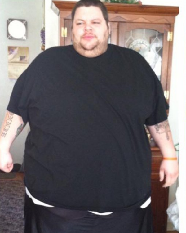 Foto - 300 kiloydu ve evden çıkamıyordu! 2 yıl sonra...