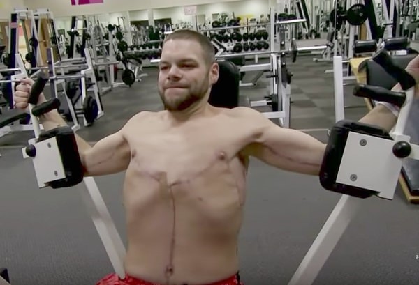 Foto - 300 kiloydu ve evden çıkamıyordu! 2 yıl sonra...