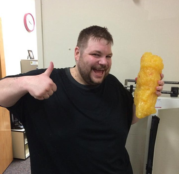 Foto - 300 kiloydu ve evden çıkamıyordu! 2 yıl sonra...