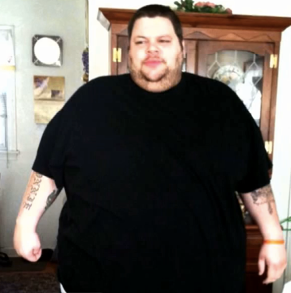 Foto - 300 kiloydu ve evden çıkamıyordu! 2 yıl sonra...