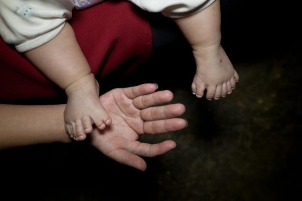 Foto - 31 parmaklı bebek şaşırtıyor!