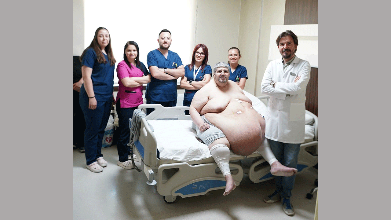 310 kiloluk hasta, sedyede geldi yürüyerek çıktı