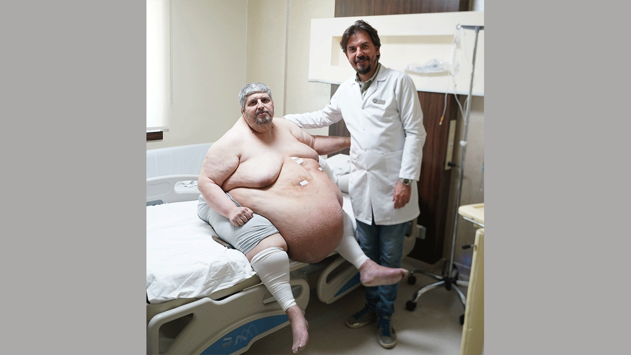 Foto - 310 kiloluk hasta, sedyede geldi yürüyerek çıktı