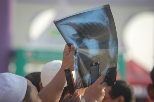 Foto - 33 yıl sonra tekrar yaşandı!