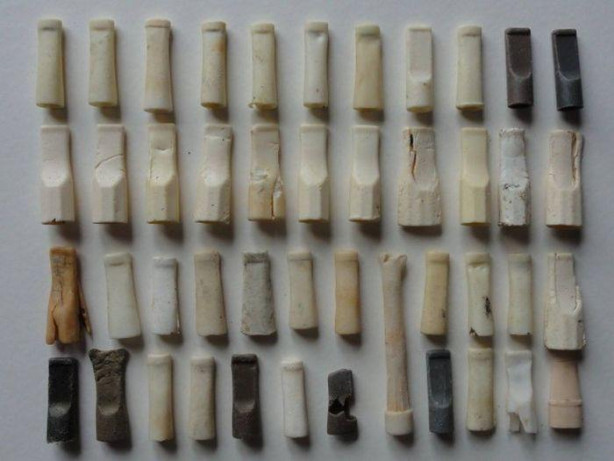 Foto - 35 poşet çöp topladı! İçinden çıkanlar şaşırttı