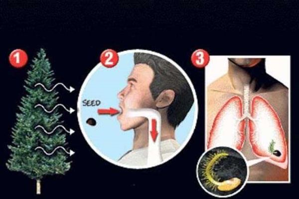 Foto - 36 yıl sonra midesinden kardeşi çıktı!