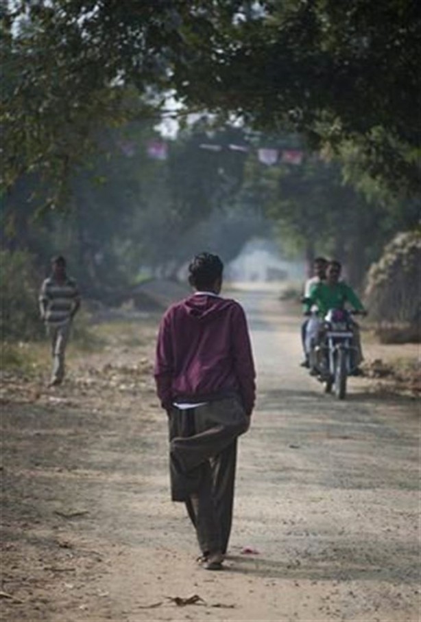 Foto - 4 bacaklı adam görenleri hayrete düşürüyor