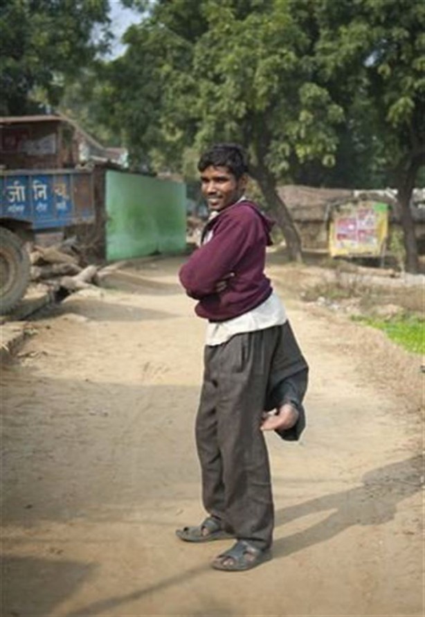 Foto - 4 bacaklı adam görenleri hayrete düşürüyor