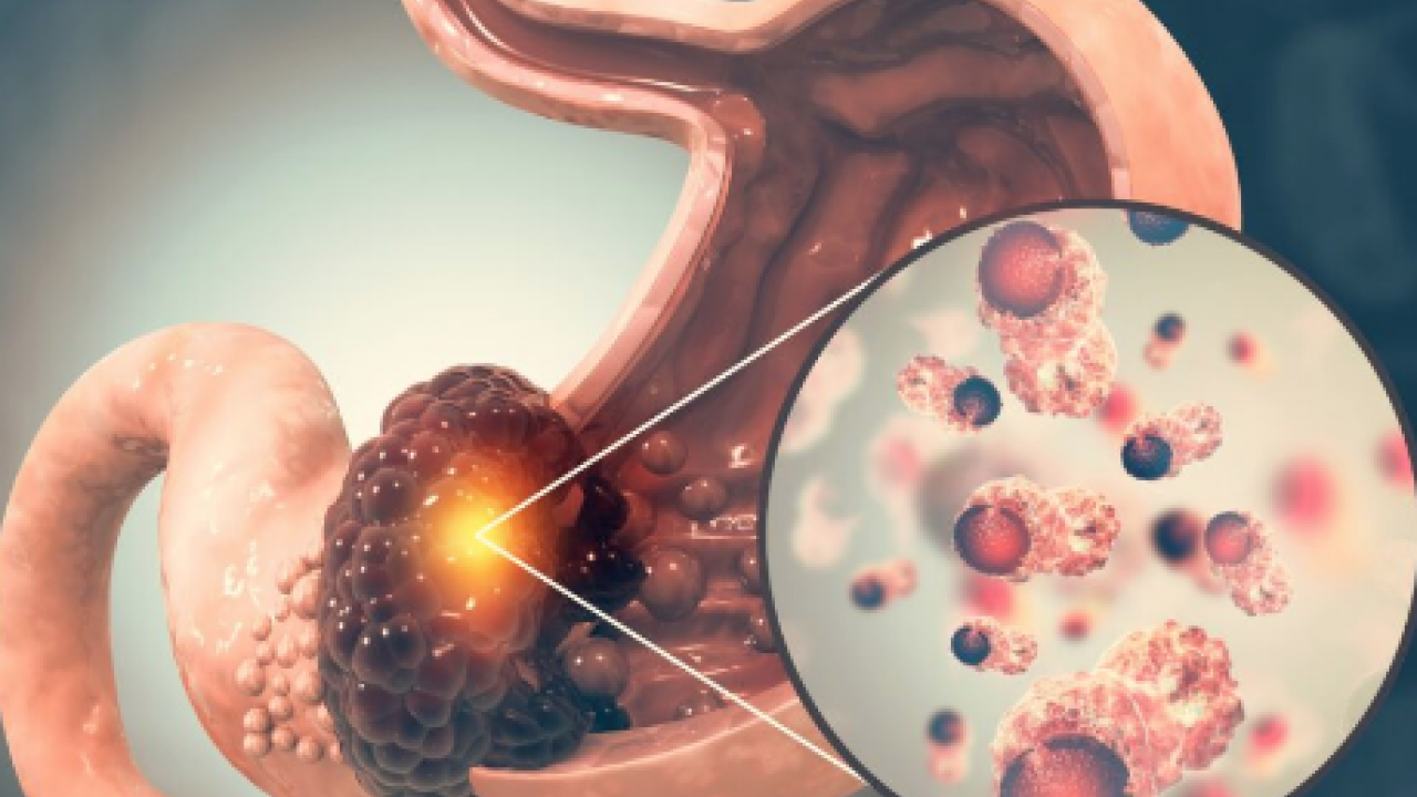 40 yaş üzerindeyseniz bu uyarılara kulağınızı tıkamayın! Genel cerrahi uzmanı açıkladı