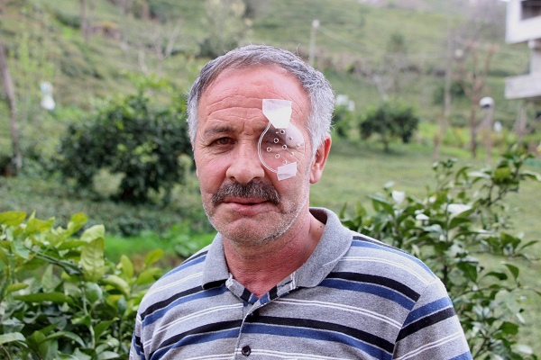 Foto - 50 yaşındaki adam bir gözünü kaybetti! Lastik deyip geçmeyin canından oluyordu