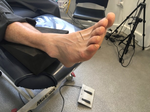 Foto - 50 yaşından sonra aman dikkat! Ayaklarınızda bunlar oluyorsa...