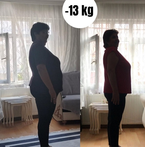 Foto - 6 ayda 700 kişi adeta eridi