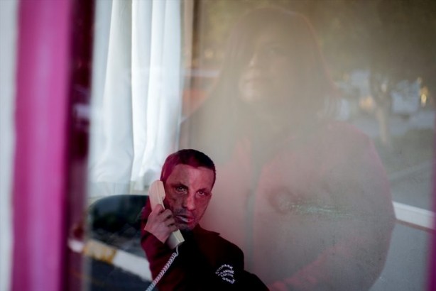 Foto - 7 yıl önce yüz nakli olmuştu... İşte son hali