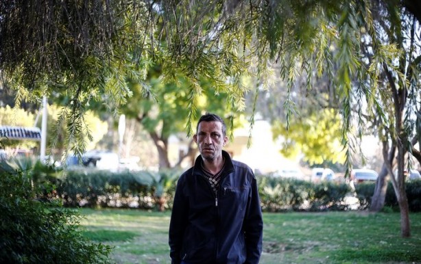 Foto - 7 yıl önce yüz nakli olmuştu... İşte son hali