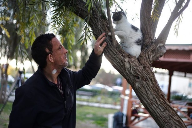 Foto - 7 yıl önce yüz nakli olmuştu... İşte son hali