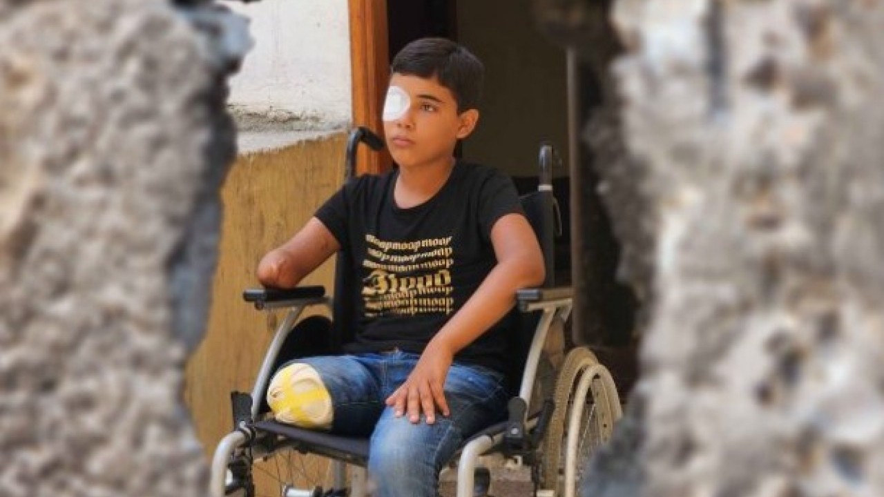 Foto - 700 gündür katliam sürüyor: Soykırımcı İsrail'in Gazze'deki korkunç istatistiği!