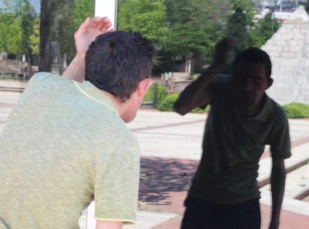 Foto - 7,5 yıl önce yüz nakli olmuştu! İşte son hali