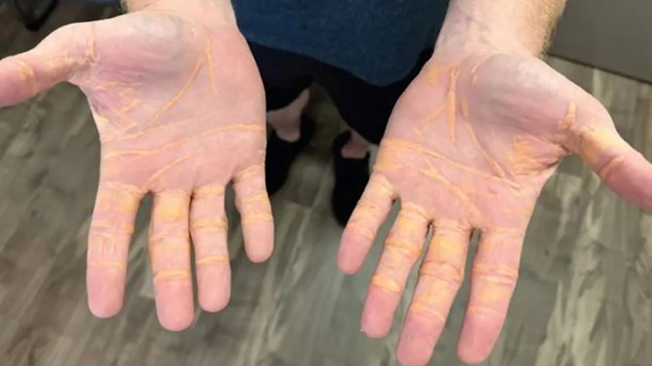 Foto - 8 ay boyunca sadece et ve tereyağı yedi! Hastanelik oldu, sonuçları şaşkına çevirdi