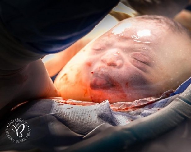 Foto - 80 binde bir görülüyor! Yeni doğan bebeği görenler şok oldu