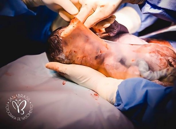 Foto - 80 binde bir görülüyor! Yeni doğan bebeği görenler şok oldu