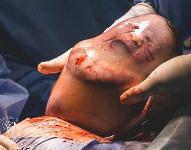 Foto - 80 binde bir görülüyor! Yeni doğan bebeği görenler şok oldu