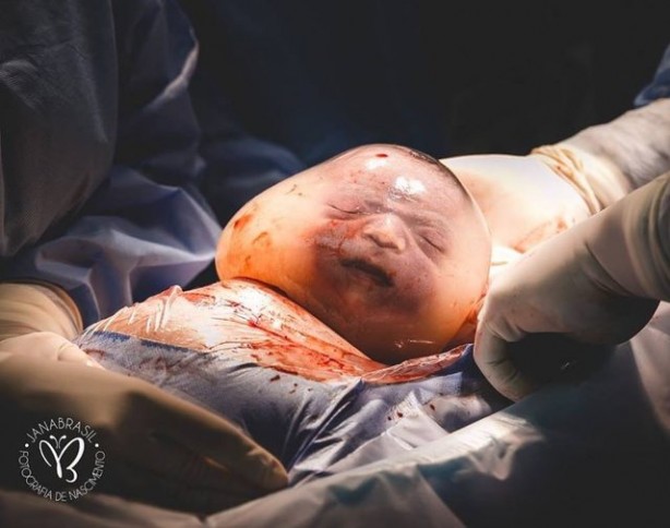 Foto - 80 binde bir görülüyor! Yeni doğan bebeği görenler şok oldu
