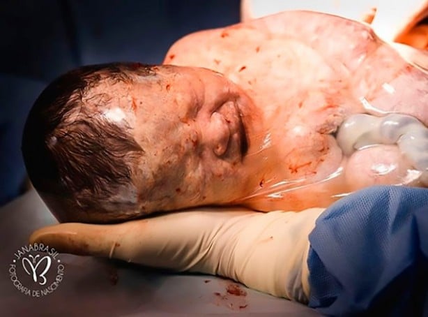 Foto - 80 binde bir görülüyor! Yeni doğan bebeği görenler şok oldu