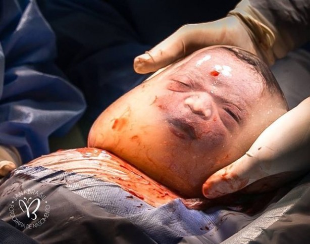 Foto - 80 binde bir görülüyor! Yeni doğan bebeği görenler şok oldu