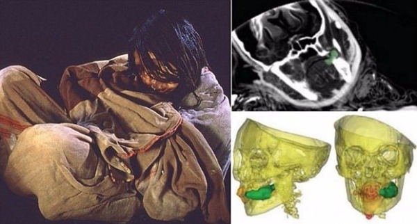 Foto - 800 yıllık mumyadaki inanılmaz gizemler