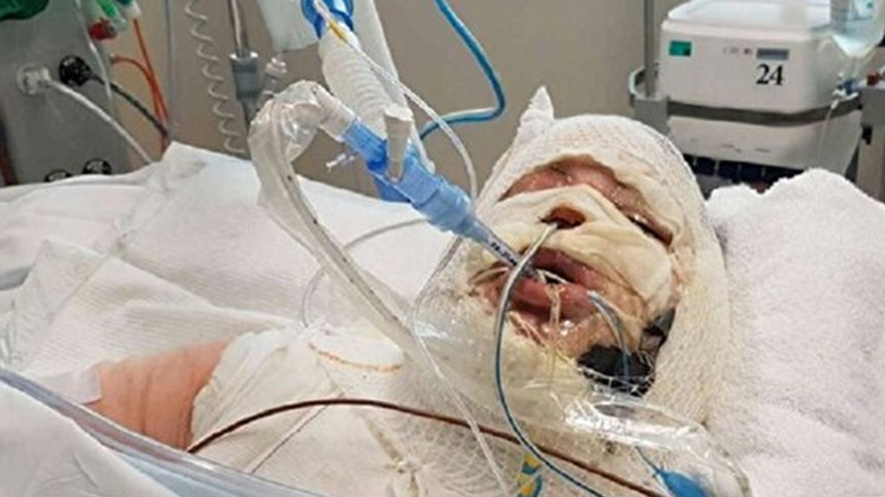 Foto - A kan grubundaki böbrek, 0'a dönüştürüldü!