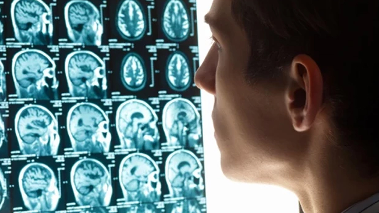 Foto - A kan grubundaki böbrek, 0'a dönüştürüldü!