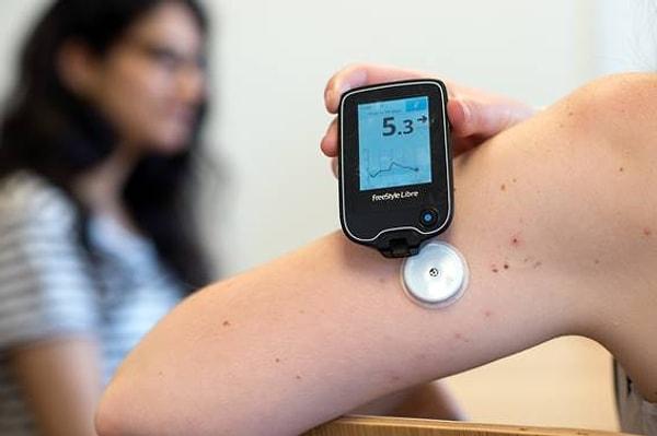 Foto - ABD Sağlık Bakanlığı Akıllı Saatlerle İlgili Uyardı! "Ölüme Neden Olabilir"