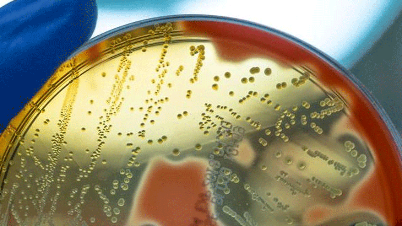 Foto - ABD'de alarm verildi: 4 kişi hayatını kaybetti!