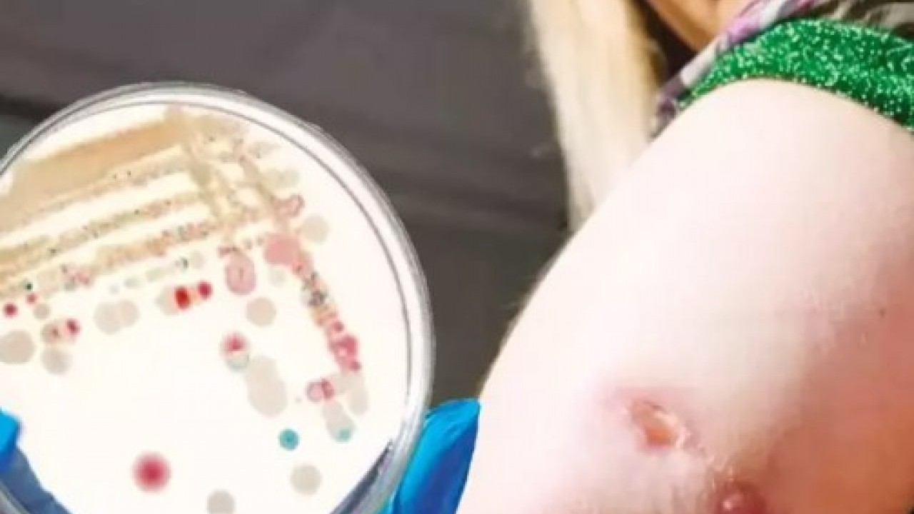 Foto - ABD'de alarm verildi: 4 kişi hayatını kaybetti!