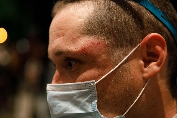 Foto - ABD'de şehir karıştı, ortalık savaş alanına döndü! Ordu sokağa indi