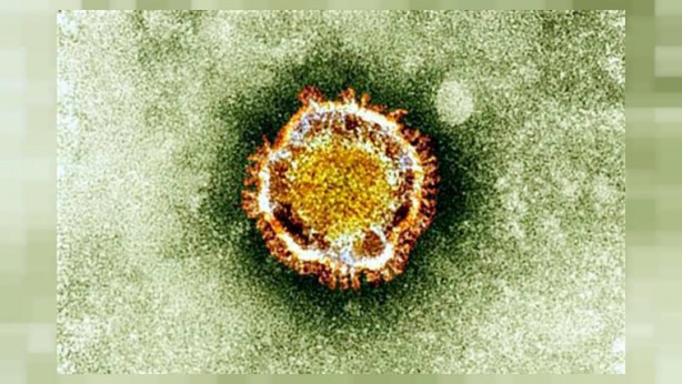 Foto - ABD'den yeni açıklama: Koronavirüs orada üretildi