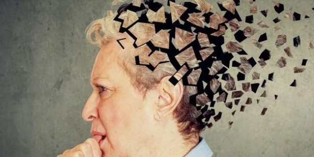 Foto - ABD'li bilim insanları tarihi keşif diyerek duyurdu: 86 farklı insanda test alzheimer için umut verdi!