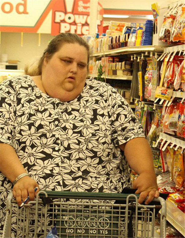 Foto - Abur cuburu kesince bakın nasıl zayıfladı!