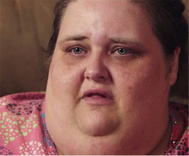 Foto - Abur cuburu kesince bakın nasıl zayıfladı!