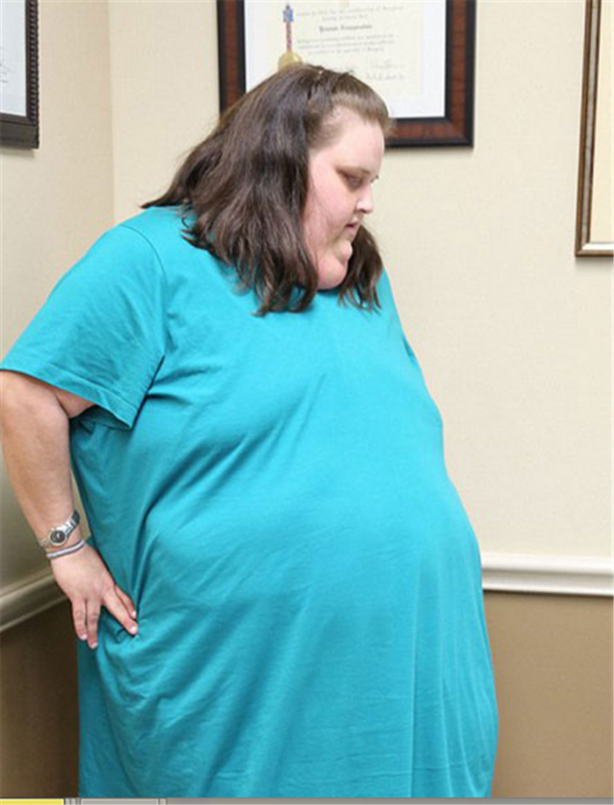 Foto - Abur cuburu kesince bakın nasıl zayıfladı!