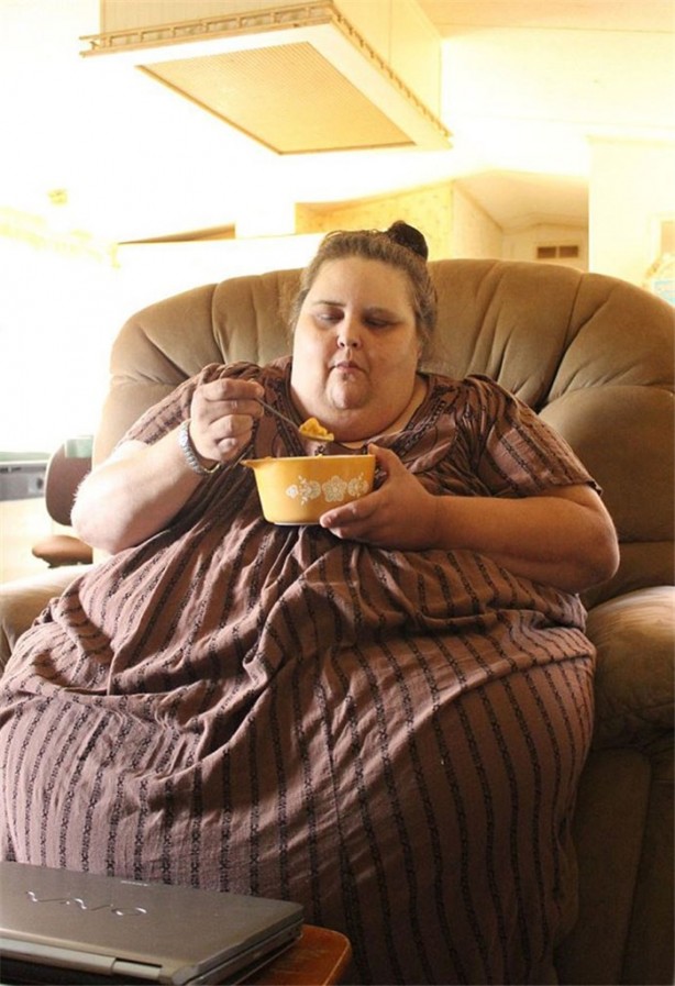 Foto - Abur cuburu kesince bakın nasıl zayıfladı!