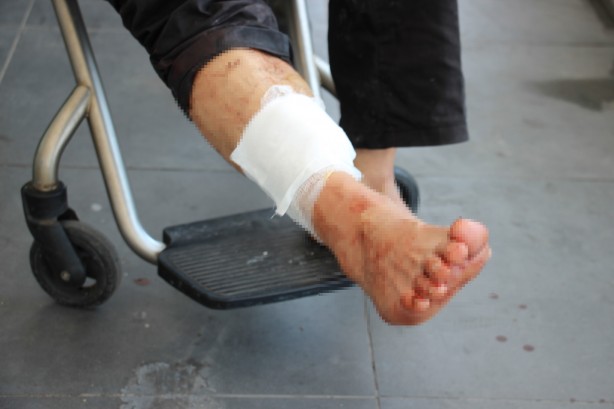 Foto - Acemi kasaplar hastanelere akın etti!