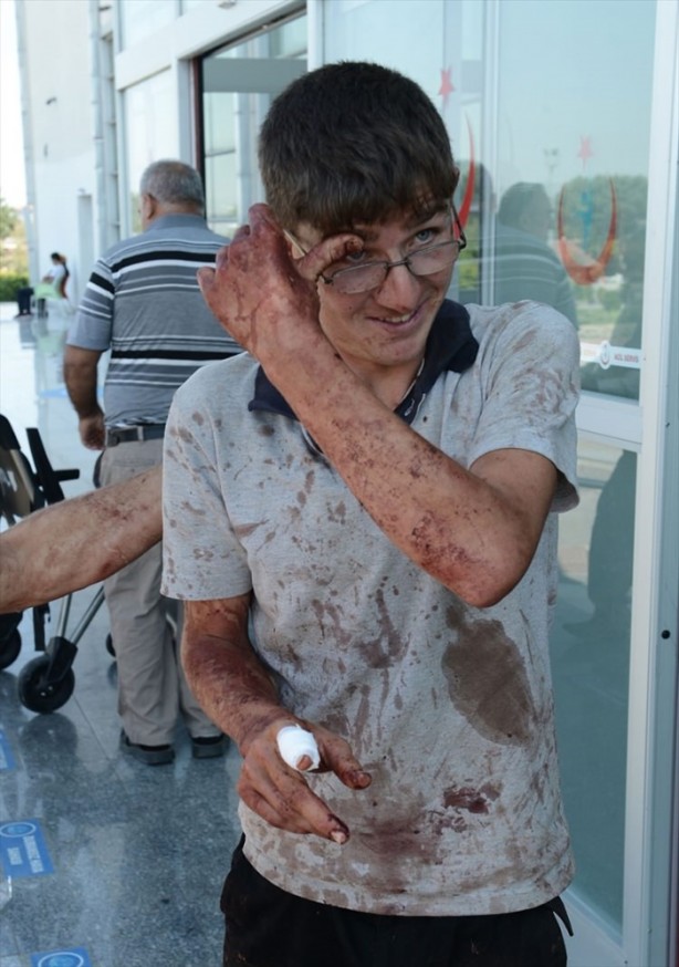 Foto - Acemi kasaplar hastanenin yolunu tuttu!