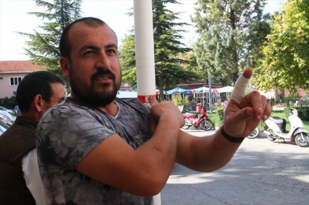 Foto - Acemi kasaplar hastanenin yolunu tuttu!