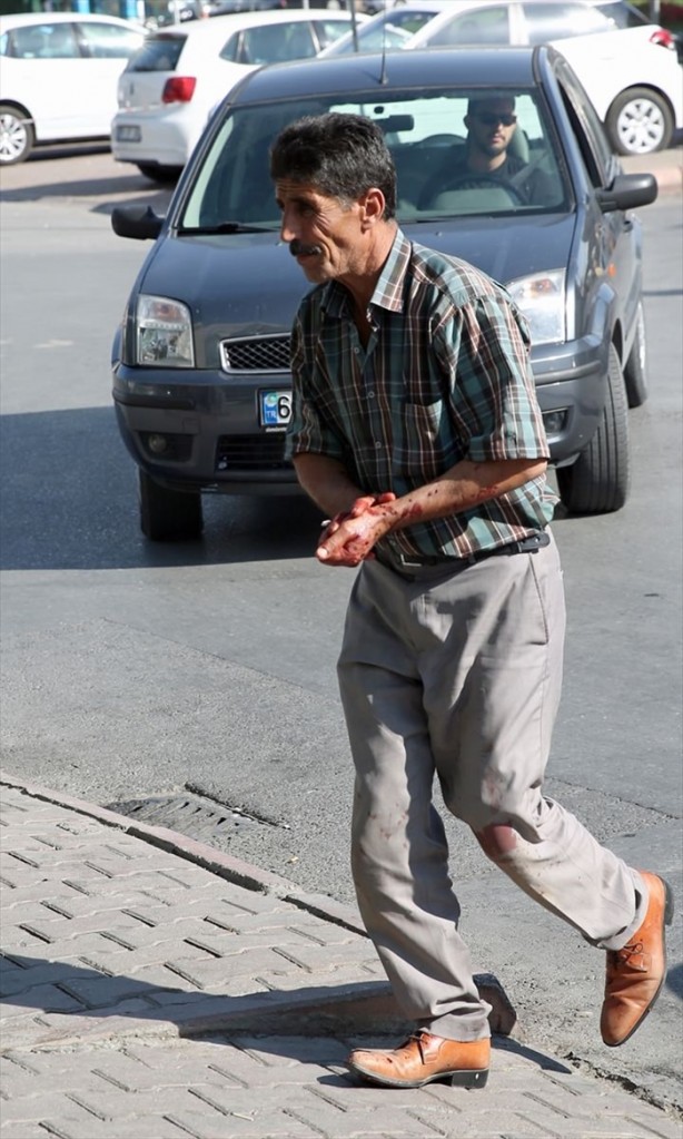 Foto - Acemi kasaplar hastanenin yolunu tuttu!