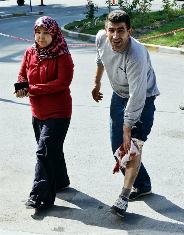 Foto - Acemi kasaplar hastanenin yolunu tuttu!