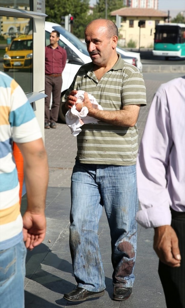 Foto - Acemi kasaplar hastanenin yolunu tuttu!