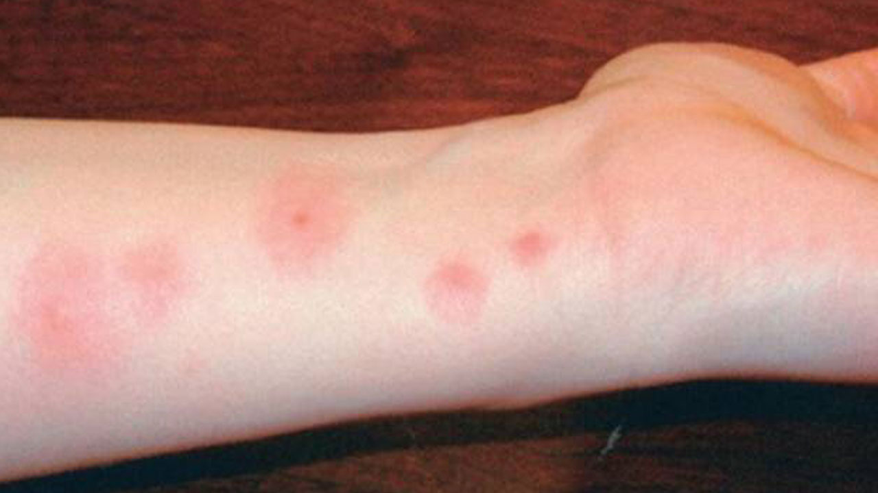 Foto - Açık havanın bedeli ağır olmasın! Çocuklarınızın sağlığı için bunları ihmal etmeyin