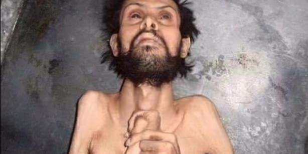 Foto - Açlığın şehri Madaya nasıl bu hale geldi?